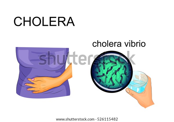 Illustration Cholera Pathogen Vibrio Cholerae 库存矢量图（免版税）526115482 ...