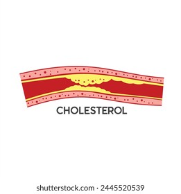 Ilustración de colesterol, Arte vectorial.
