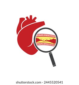 Ilustración de colesterol, Arte vectorial.