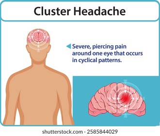 Illustration of cluster headache pain and brain area