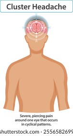 Illustration of cluster headache pain and location