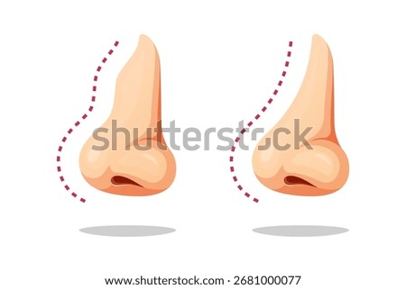 Illustration comparison of nose after plastic surgery .Crooked human nose with signs of plastic surgery.