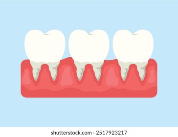 illustration of the concept of teeth and gums, flat style vector illustration.