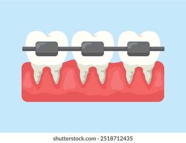 Ilustração do conceito de dentes usando chaves, ilustração vetorial de estilo plano.