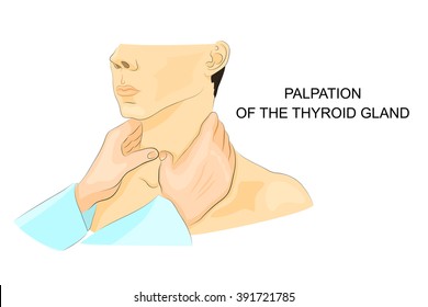 illustration of correct palpation of the thyroid gland