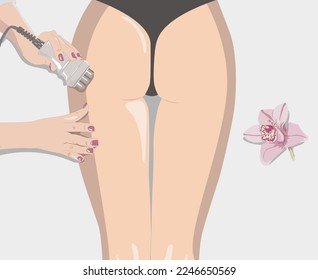 ilustración. El cosmetólogo hace el procedimiento de elevación Rf en las piernas, nalgas y caderas de una mujer en un salón de belleza. Tratamiento del sobrepeso y la piel inflamada.	