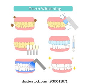 Ilustración de cosmetología y blanqueamiento dental