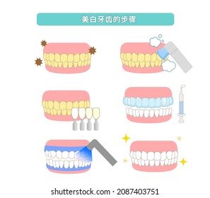 Ilustración de la traducción de cosmetología y blanqueamiento dental; Escala de blanqueamiento en la clínica doméstica y dental, guía sombreada, gel blanqueador
