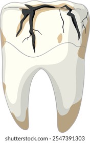 Illustration of a cracked, decayed tooth