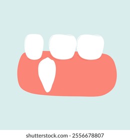 Illustration of Crooked Teeth Problem