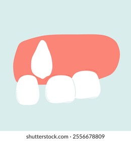 Illustration of Crooked Teeth Problem