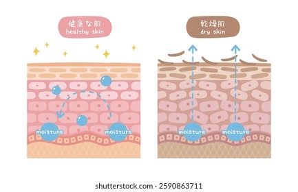 Illustration of cross section of healthy skin and dry skin