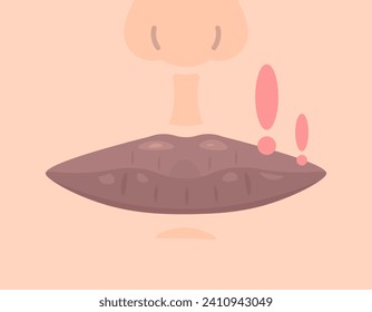 eine Illustration von dunklen oder schwarzen Lippen. Lippen dunkeln. Die Lippen werden dunkel, weil sie häufig rauchen und Sonnenlicht ausgesetzt sind. Lippenkrankheit. Flachbilddesign. grafische Elemente. Vektorgrafik