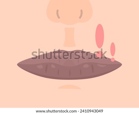 an illustration of dark or black lips. lips darken. lips become dark due to frequent smoking and exposure to sunlight. lip health condition. flat illustration design. graphic elements. vector
