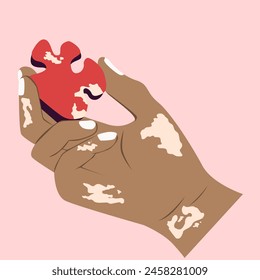 Illustration of a dark skin hand with vitiligo holding a vitiligo-patterned red puzzle isolated on pink backgorund 