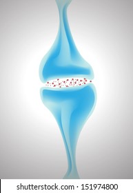 illustration of a dendrite 