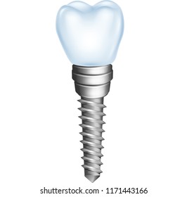 Illustration of dental implant isolated on white background