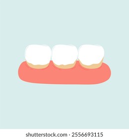 Illustration of Dental Plaque Teeth 