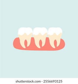 Illustration of Dental Plaque Teeth 