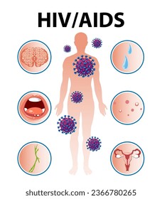 Ilustración de las repercusiones del VIH/SIDA en el cuerpo humano