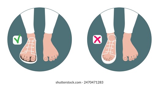 An illustration depicting shoes that are detrimental to foot health and shoes that are preferable for the foot