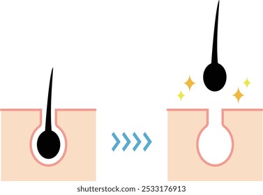 Ilustração de depilação e limpeza da pele