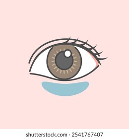 Ilustración de diferentes tipos de ojeras