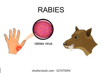 Illustration Of A Dog Bite, Sick Animal, The Rabies Virus
