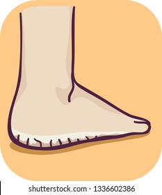 Illustration of a Dry and Thick Skin of the Feet