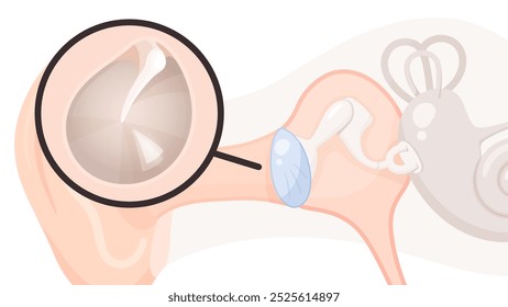 Ilustración de la estructura del oído y tímpano_Tímpano normal