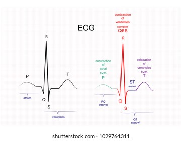 Illustration Of ECG Interpretation. ECG Of A Healthy Person