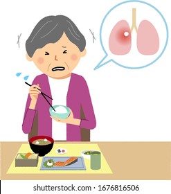 Illustration of an elderly person who aspirated during a meal.