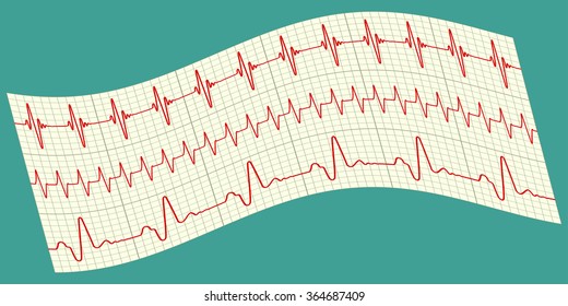 Illustration of the electrocardiograms icon
