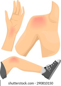 Illustration of Elements Featuring Common Types of Body Pain