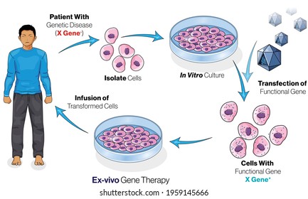 illustration of Ex vivo gene therapy in humans. Gene therapy for sickle cell anemia, hemophilia, Muscular Dystrophy. 