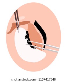 Illustration of extension of eyelashes, how to place false eyelashes