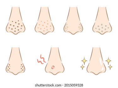 Illustration of fashionable touch nose pore dirt