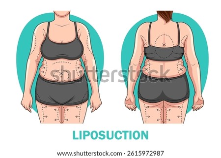 illustration of female body showing difference between before and after of Liposuction procedure. Weight loss and wellness concept