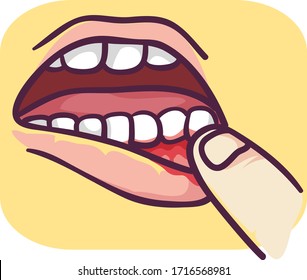 Illustration of a Finger Pushing Lips to Show Bleeding Gums