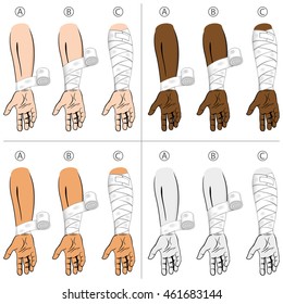 Illustration first aid forearm ethnic, educational simple dressing. Ideal for medical catalogs, informational and institutional material
