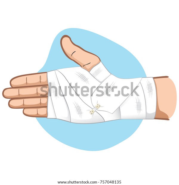 Illustration First Aid Hands Bandage Bandage Stock Vector (Royalty Free ...