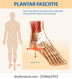 Illustration of foot anatomy and pain points