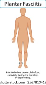 Illustration of foot pain and its common symptoms