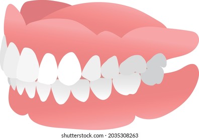 Ilustración de dentaduras completas (ángulo lateral)