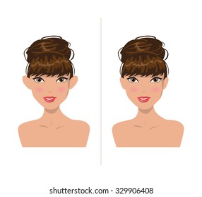 Illustration of a girl before and after plastic surgery on ears