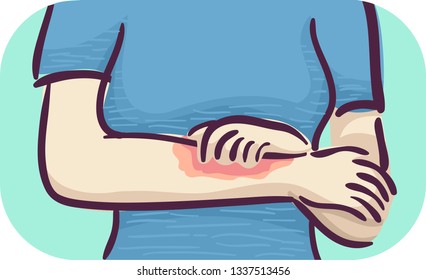 Illustration of a Girl Holding Her Arm with Red and Itchy Skin