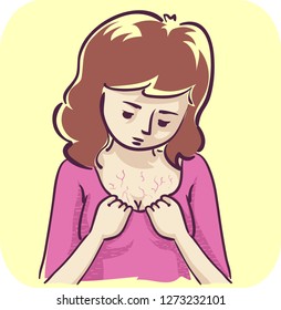 Illustration of a Girl Looking at Veins on Her Chest