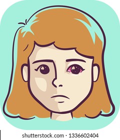 Illustration of Girl with Pink Eye, a Gonorrhea Symptom