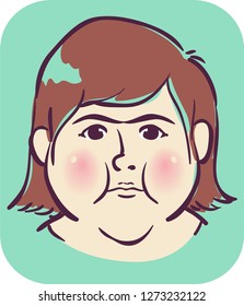 Illustration of a Girl with Red, Puffy and Round Face