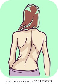 Illustration of a Girl Showing Her Deformed Back Bone